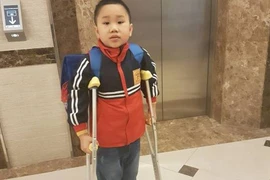 Đề nghị không khởi tố lái xe làm gãy chân học sinh, dù giám định thương tật 32%