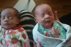 20 tuổi sinh 3 cặp song sinh