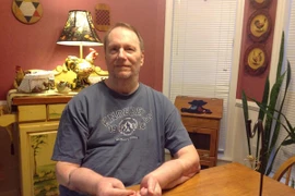  Người đàn ông muốn bỏ đi cả 2 cánh tay 