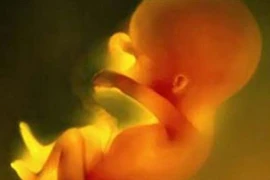 Bào thai trong bụng cụ bà 92 tuổi