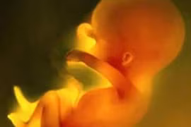 Bào thai trong bụng cụ bà 92 tuổi