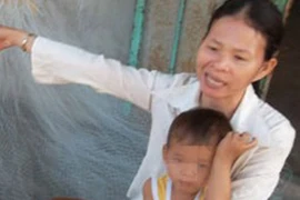 Vụ bé 20 tháng tuổi nhiều lần bị rạch mặt: Nỗi đau khó lành