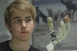 Thiết bị 3D hỗ trợ sử dụng chân tay giả