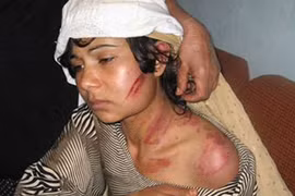 Nan giải nạn bạo hành phụ nữ 