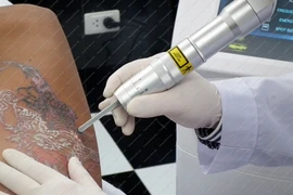 Nạn nhân của “trang điểm vĩnh viễn”