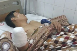 Đốt pháo đêm giao thừa, người cụt tay kẻ mù mắt