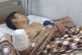 Đốt pháo đêm giao thừa, người cụt tay kẻ mù mắt