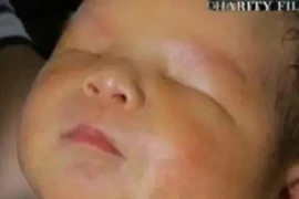 Mẹ trẻ tuyệt vọng cùng cực vì con trai sinh ra không có mắt
