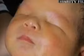 Mẹ trẻ tuyệt vọng cùng cực vì con trai sinh ra không có mắt