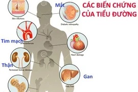 Khám và phát hiện sớm 10 bệnh lý nguy hiểm nhất thường gặp trong cuộc sống
