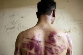 Chính quyền Syria bị tố xử tử 13.000 tù nhân đối lập