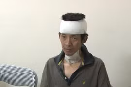 Bắt đối tượng đốt nhà, chém trọng thương chị gái