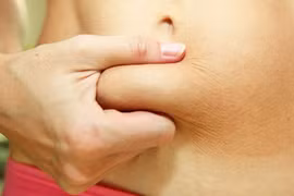 Phụ nữ béo phì dễ bị ung thư nội mạc tử cung