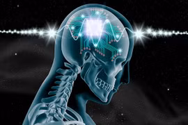 Cấy chip vào não để tăng trí thông minh 