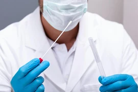 Tối 13-7: Thêm 852 ca mắc Covid-19, số ca bệnh trong ngày tiếp tục tăng