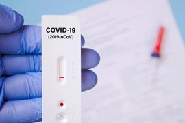 Người dân có nên tự mua dụng cụ xét nghiệm nhanh Covid-19?