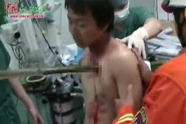 May mắn thoát chết dù bị cọc tre 2m xuyên thấu lồng ngực