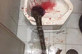 Trăn dài 3,3m chui lên bệt vệ sinh, tấn công bộ phận sinh dục người đàn ông
