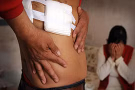 Sốc: Đi phẫu thuật ngực bị cắt trộm thận lúc nào không hay