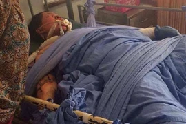 Bị chồng đổ xăng đốt vì đăng ảnh "tự sướng" trên Facebook