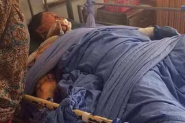 Bị chồng đổ xăng đốt vì đăng ảnh "tự sướng" trên Facebook