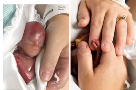 Mẹ đau xót chụp ảnh con vừa sinh đã qua đời sau vài phút
