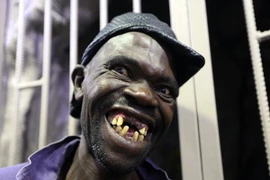 Chiêm ngưỡng dung nhan người đàn ông xấu xí nhất thế giới