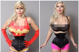 Cô gái cắt phăng 6 xương sườn để có vòng eo con kiến 35cm