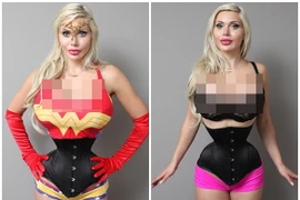 Cô gái cắt phăng 6 xương sườn để có vòng eo con kiến 35cm