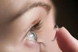 Hại mắt vì lạm dụng kính áp tròng 