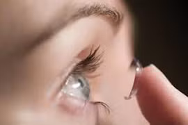 Hại mắt vì lạm dụng kính áp tròng 