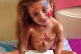 Cuộc sống đầy màu sắc của cô bé có trái tim nằm ở... bụng