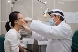 Lưu ý những dấu hiệu bệnh về mạch não khi thay đổi thời tiết