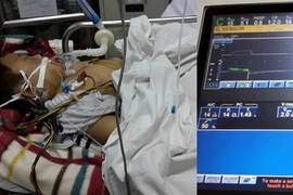 Cháu bé bị bố đánh dã man bằng điếu cày đã tử vong