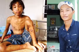 Hào Anh - Từ cậu bé bị tra tấn như thời trung cổ đến người con ngược đãi cha mẹ