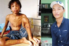 Hào Anh - Từ cậu bé bị tra tấn như thời trung cổ đến người con ngược đãi cha mẹ