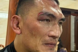 Hiếu 'khổng lồ' bị thương vùng mắt khi đấu đô vật Belarus