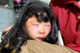 [Tin nhanh sáng 19-3-2021] Nữ sinh lớp 6 bị đánh dã man, bất tỉnh trong lô cao su