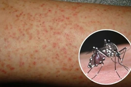 [CLIP] Những mối nguy hiểm khi tự điều trị sốt xuất huyết tại nhà