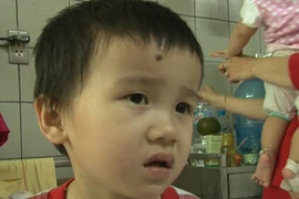 Cấp cứu cho bé trai 4 tuổi ngộ độc do uống thuốc lá cây rừng