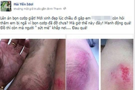 Hàng loạt sao Việt từng trầy da xước mặt vì bị cướp giật ở TP.HCM