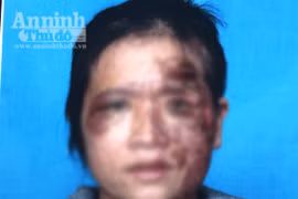 Người phụ nữ bị chồng bạo hành vì tham gia bán hàng đa cấp?