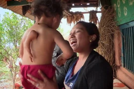 Bé trai có tay "mọc"... sau lưng