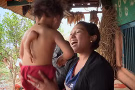 Bé trai có tay "mọc"... sau lưng