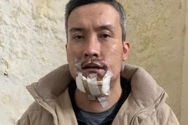 Lao vào hành hung bác sỹ và điều dưỡng bệnh viện Xanh Pôn