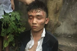 Hà Nội: Bắt gọn tên cướp táo tợn