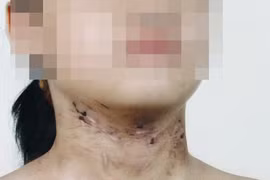 Chưa đủ căn cứ khởi tố kẻ hành hạ bé gái 6 tuổi như thời trung cổ 