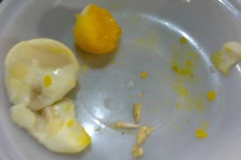 Phát hiện chất lạ trong lòng đỏ trứng gà