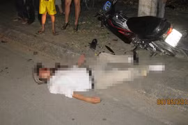 Giáo viên say rượu... tông vào trụ điện chấn thương sọ não