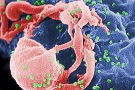 Chữa bệnh AIDS bằng thuốc trị ung thư